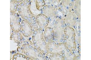 Immunohistochemistry of paraffin-embedded Mouse kidney using SLC4A4 / NBC Polyclonal Antibody at dilution of 1:100 (40x lens). (SLC4A4 Antikörper)