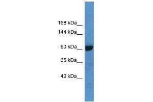 WB Suggested Anti-ABCC4 Antibody Titration: 1. (ABCC4 Antikörper  (C-Term))