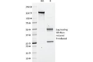 SDS-PAGE (SDS) image for anti-Sialophorin (SPN) antibody (ABIN6940634)