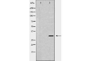Western blot analysis of extracts of HEK-293, using XPA antibody. (XPA Antikörper  (Internal Region))