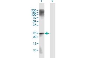 Western Blot analysis of MAD2L2 expression in transfected 293T cell line by MAD2L2 MaxPab polyclonal antibody. (MAD2L2 Antikörper  (AA 1-211))
