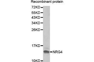 Western Blotting (WB) image for anti-Neuregulin 4 (NRG4) antibody (ABIN1873958) (Neuregulin 4 Antikörper)