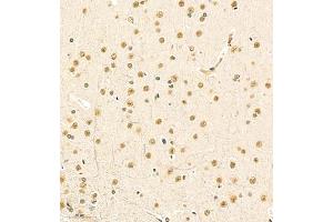 Immunohistochemistry of paraffin embedded rat brain using MED17 (ABIN7074579) at dilution of 1:1500 (200x lens)
