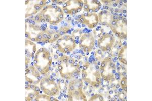 Immunohistochemistry of paraffin-embedded mouse liver using HADH antibody. (HADH Antikörper)