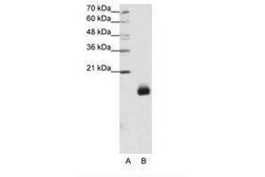Image no. 1 for anti-Ribosomal Protein S14 (RPS14) (N-Term) antibody (ABIN203013) (RPS14 Antikörper  (N-Term))