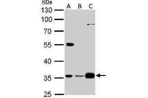 WB Image GAS2L1 antibody detects GAS2L1 protein by Western blot analysis. (GAS2L1 Antikörper)
