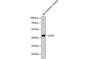 Western blot analysis of extracts of Rat skeletal muscle using AGXT Polyclonal Antibody at dilution of 1:1000. (AGXT Antikörper)