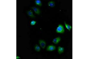 Immunofluorescence staining of A549 cells with ABIN7169933 at 1:100, counter-stained with DAPI. (SCN1B Antikörper  (AA 44-156))