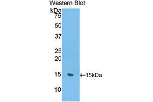Western blot analysis of the recombinant protein. (UCP1 Antikörper  (AA 179-296))