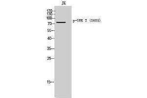 Western Blotting (WB) image for anti-Adrenergic, Beta, Receptor Kinase 1 (ADRBK1) (pSer685) antibody (ABIN3173109) (GRK2 Antikörper  (pSer685))