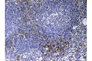 Immunohistochemistry (IHC) image for anti-CD14 (CD14) (AA 16-260) antibody (ABIN5518974)