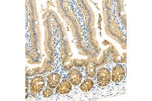 Immunohistochemistry (Paraffin-embedded Sections) (IHC (p)) image for anti-LI Cadherin antibody (ABIN7074493)