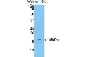 Western Blotting (WB) image for anti-ADAM Metallopeptidase with Thrombospondin Type 1 Motif, 7 (ADAMTS7) (AA 226-437) antibody (ABIN3205719) (ADAMTS7 Antikörper  (AA 226-437))