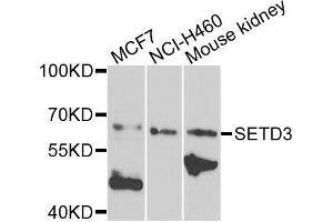 Western blot analysis of extracts of various cells, using SETD3 antibody.