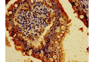 Immunohistochemistry of paraffin-embedded human small intestine tissue using ABIN7146190 at dilution of 1:100 (E-cadherin Antikörper  (AA 153-641))