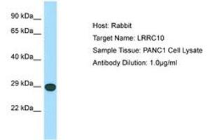 Image no. 1 for anti-Leucine Rich Repeat Containing 10 (LRRC10) (C-Term) antibody (ABIN6750054) (LRRC10 Antikörper  (C-Term))
