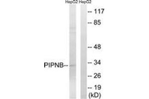 Western blot analysis of extracts from HepG2 cells, using PITPNB Antibody.