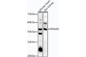 Western blot analysis of extracts of various cell lines, using PDGFD antibody (ABIN7269393) at 1:1000 dilution.