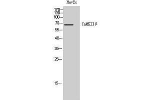 Western Blotting (WB) image for anti-Calcium/calmodulin-Dependent Protein Kinase II beta (CAMK2B) (Internal Region) antibody (ABIN3180521) (CAMK2B Antikörper  (Internal Region))