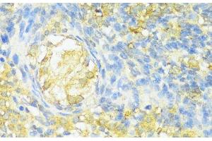 Immunohistochemistry of paraffin-embedded Rat ovary using HLA-DPB1 Polyclonal Antibody at dilution of 1:100 (40x lens). (HLA-DPB1 Antikörper)