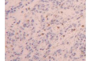 DAB staining on IHC-P; Samples: Human Spleen Tissue (ZYX Antikörper  (AA 384-572))