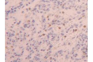 DAB staining on IHC-P; Samples: Human Spleen Tissue