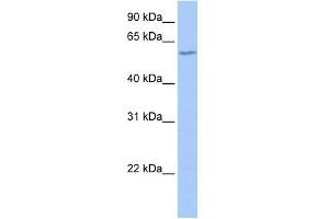 DNTT antibody used at 1 ug/ml to detect target protein. (TdT Antikörper  (N-Term))