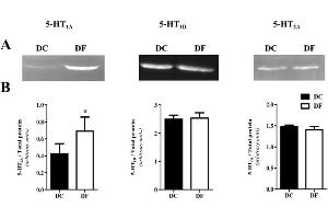 5-HT1A/1D/2A receptor expression in thoracic aortas from control (DC) and fluoxetine-treated (DF) diabetic rats by Western blot. (HTR2A Antikörper  (AA 51-150))