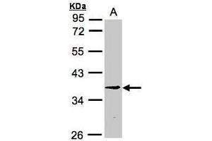 WB Image Sample (30μg whole cell lysate) A:H1299 10% SDS PAGE antibody diluted at 1:3000 (RPF2 Antikörper)