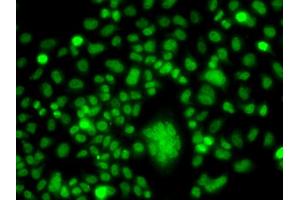 Immunofluorescence analysis of A549 cells using PPAN antibody (ABIN5975126). (PPAN Antikörper)