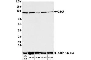 Western Blotting (WB) image for anti-CCCTC-Binding Factor (Zinc Finger Protein) (CTCF) (AA 650-700) antibody (ABIN7453967) (Rekombinanter CTCF Antikörper  (AA 650-700))