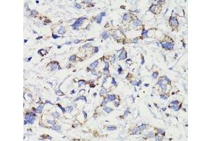 Immunohistochemistry (Paraffin-embedded Sections) (IHC (p)) image for anti-Programmed Cell Death 10 (PDCD10) antibody (ABIN7009630)