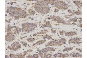 Immunohistochemistry (IHC) image for anti-GDP Dissociation Inhibitor 1 (GDI1) antibody (ABIN1876650) (GDI1 Antikörper)