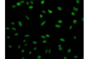 Immunofluorescence staining of Hela Cells with ABIN7127789 at 1:50, counter-stained with DAPI. (Rekombinanter Retinoblastoma Binding Protein 4 Antikörper)