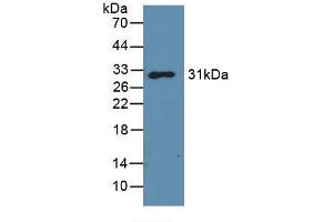 Figure. (Galectin 3 Antikörper  (AA 2-264))