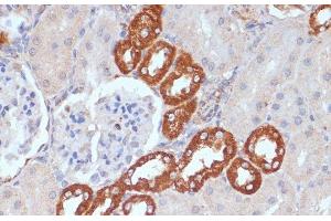 Immunohistochemistry of paraffin-embedded Rat kidney using PDGFR beta Polyclonal Antibody at dilution of 1:100 (40x lens). (PDGFRB Antikörper)