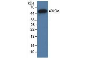 Detection of Recombinant GR, Human using Polyclonal Antibody to Glucocorticoid Receptor (GR) (Glucocorticoid Receptor Antikörper  (AA 598-755))
