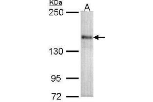 WB Image Sample (30 ug of whole cell lysate) A: 293T 5% SDS PAGE antibody diluted at 1:1000 (CACNA1S Antikörper  (Center))