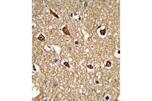 Immunohistochemistry (Paraffin-embedded Sections) (IHC (p)) image for anti-Major Histocompatibility Complex, Class II, DR beta 1 (HLA-DRB1) (AA 30-58) antibody (ABIN390872)