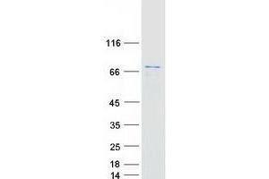 Western Blotting (WB) image for Protein Phosphatase 2, Regulatory Subunit B', delta (PPP2R5D) (Transcript Variant 2) protein (Myc-DYKDDDDK Tag) (ABIN2729499)