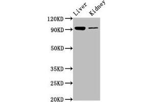 Western Blot Positive WB detected in: Mouse liver tissue, Mouse kidney tissue All lanes: DMGDH antibody at 6. (DMGDH Antikörper  (AA 429-524))