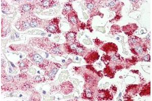 Anti-SCP2 antibody IHC staining of human liver.