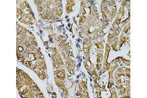 Immunohistochemistry of paraffin-embedded Human stomach using MYL1 Polyclonal Antibody at dilution of 1:100 (40x lens).