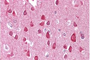 Brain, cortex (SLC18A1 Antikörper  (Middle Region))
