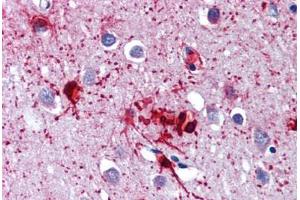 Brain, cortex, Human: Formalin-Fixed, Paraffin-Embedded (FFPE) (DDX58 Antikörper)