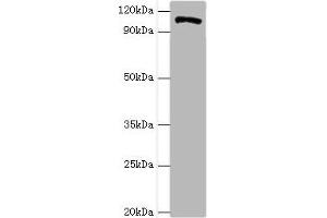 Western blot All lanes: HIP1 antibody at 4 μg/mL + A549 whole cell lysate Secondary Goat polyclonal to rabbit IgG at 1/10000 dilution Predicted band size: 117, 111, 114 kDa Observed band size: 117 kDa (HIP1 Antikörper  (AA 410-690))