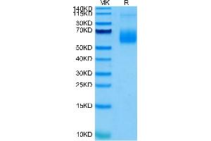 Human Siglec-6 on Tris-Bis PAGE under reduced condition. (SIGLEC6 Protein (AA 27-331) (His-Avi Tag))