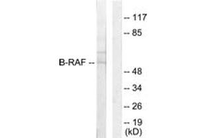 Western blot analysis of extracts from HeLa cells, using B-RAF Antibody. (SNRPE Antikörper  (AA 171-220))