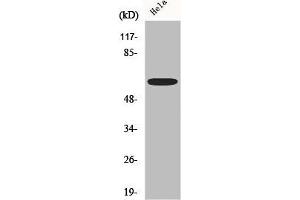 Western Blot analysis of Hela cells using AATF Polyclonal Antibody (AATF Antikörper  (N-Term))