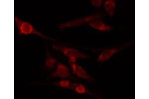 ABIN6274032 staining HepG2 by IF/ICC. (HSF1 Antikörper  (pSer326))